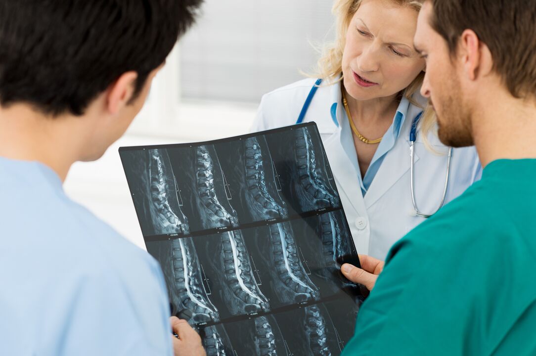 Diagnostics de l'ostéochondose
